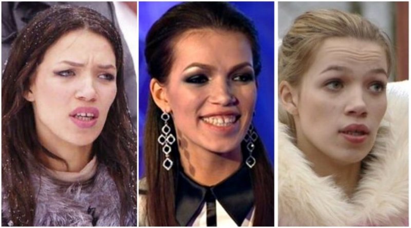 До и после. Гламурные россиянки, спустившие миллионы на "тюнинг"