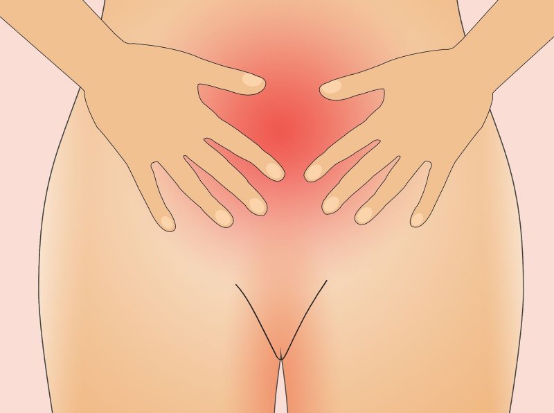Что такое эндометрий. Полип эндометрия, причины и лечение