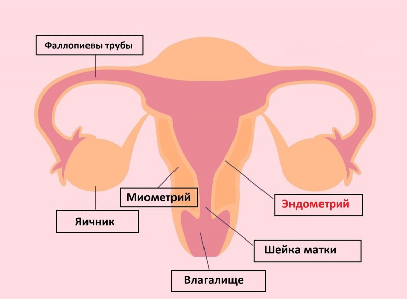 Что такое эндометрий. Полип эндометрия, причины и лечение