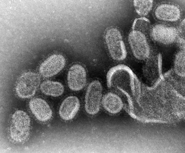 Почему в Италии так много жертв коронавируса: 5 версий