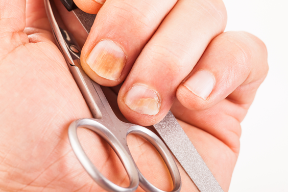 Не делайте так! 8 безобидных привычек, которые уродуют ваши ногти
