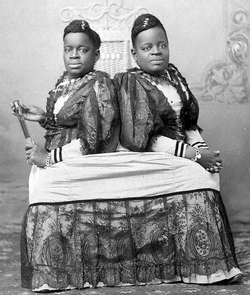 Сиамские близнецы история и фото