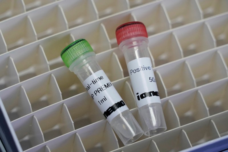 Не только ПЦР. Какие бывают тесты на коронавирус и чем они отличаются