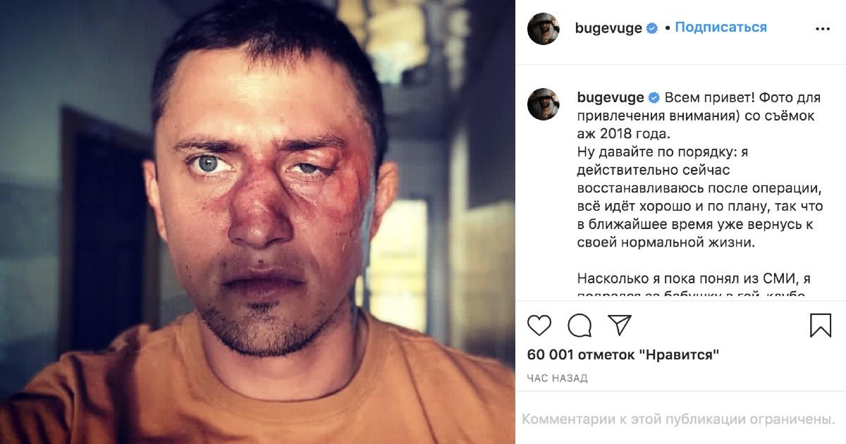 Павел Прилучный после операции обратился к поклонникам