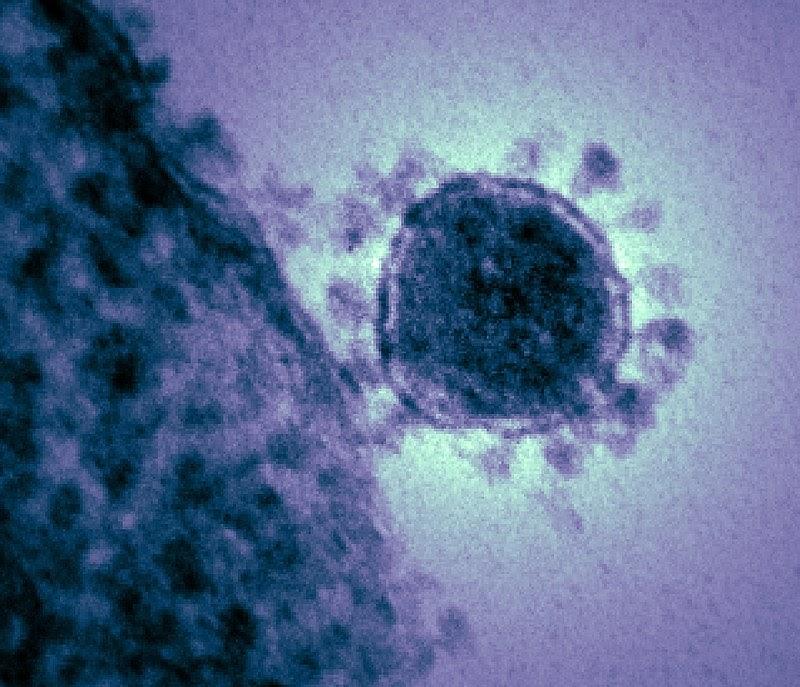 Почему молодые и здоровые тяжело и долго болеют коронавирусом