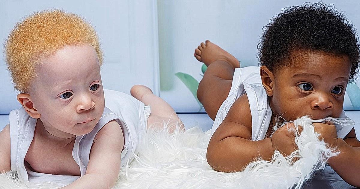 Женщина родила черного и абсолютно белого ребенка. Как отреагировал отец