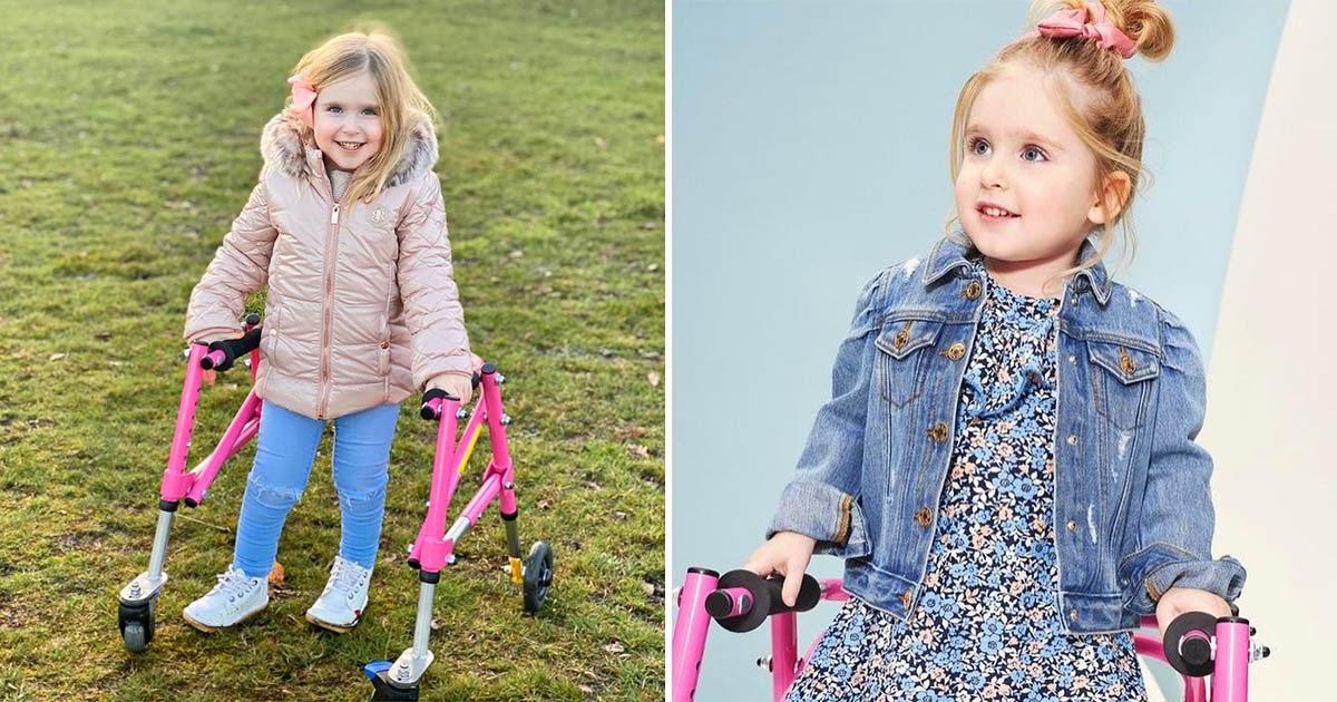 4-летняя девочка смогла ходить вопреки прогнозу врачей и даже стала моделью