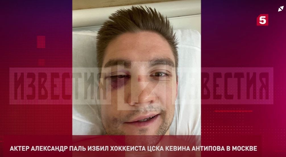 Актер Александр Паль избил хоккеиста в центре Москвы