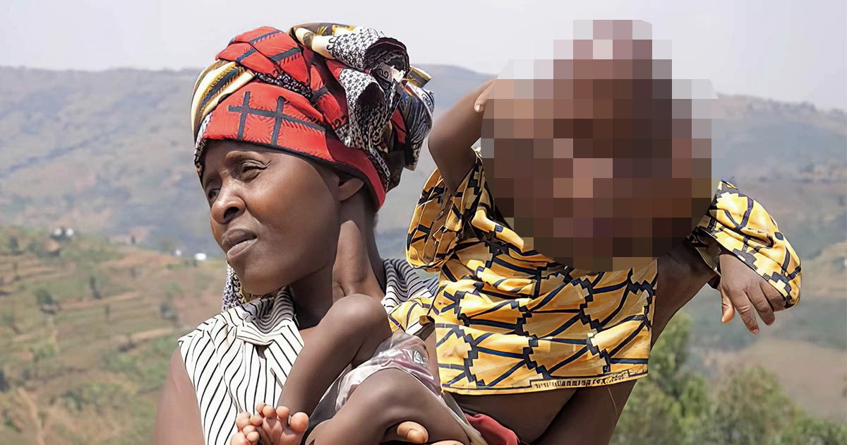 Африканка родила ребенка с головой в форме груши и потеряла мужа и работу