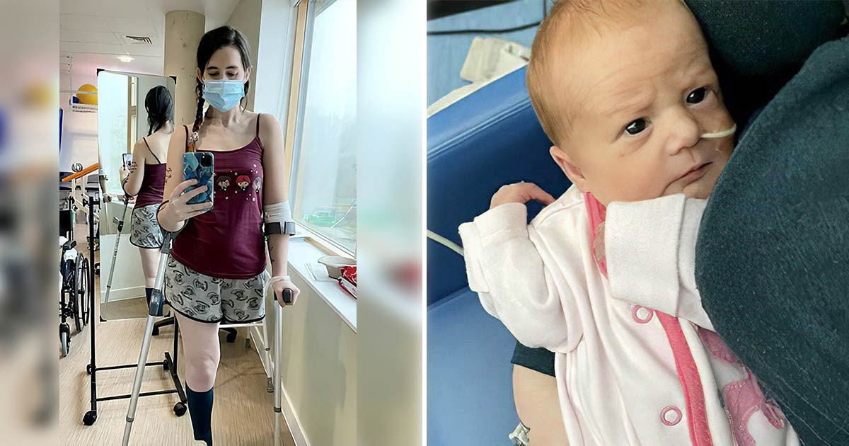 Беременная британка пожертвовала ногой, чтобы сохранить жизнь дочери
