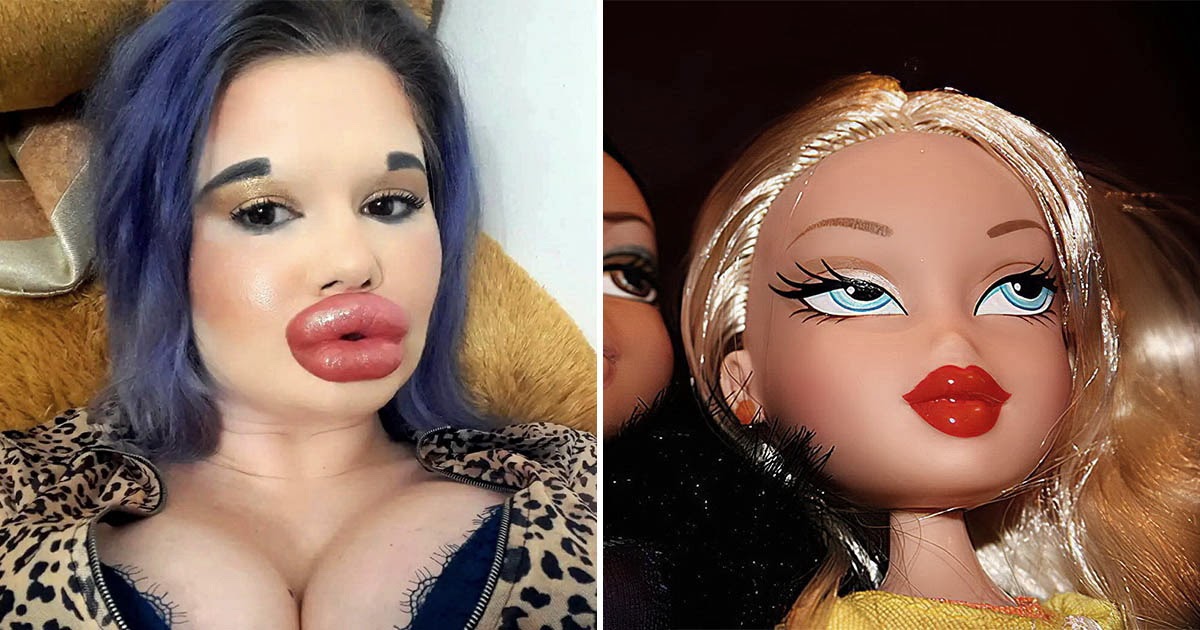 Мечтающая о лице куклы Bratz болгарка хочет увеличить губы в 27-й раз