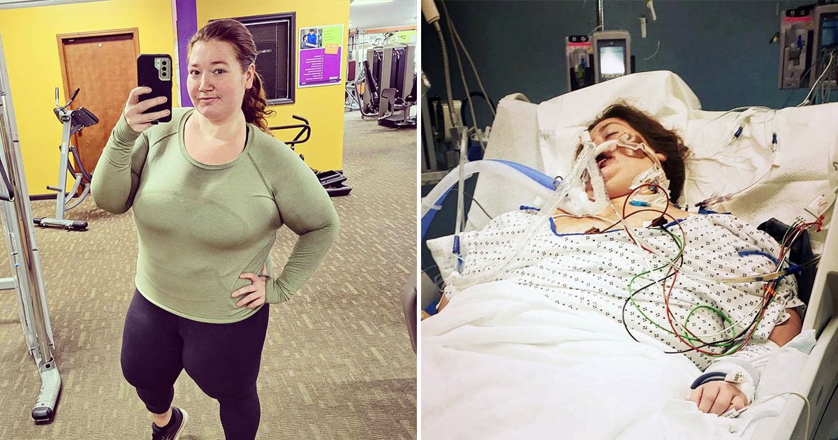 Фитнес-блогерша за два года сбросила 142 кг и оказалась в коме